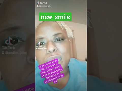 New Smile #feelgoodvibes #shinysmile #smilemakeover #feelgoodvibes