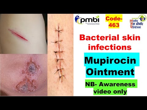 463 Mupirocin Ointment S