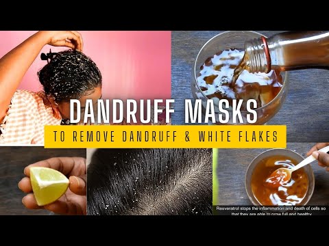 Dandruff Gone in Minutes! Try These Natural Hair Masks