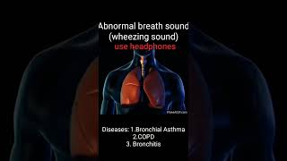 Wheezing/abnormal breath sound/Asthma/COPD/Bronchitis/How to different wheezing sound#Med school way