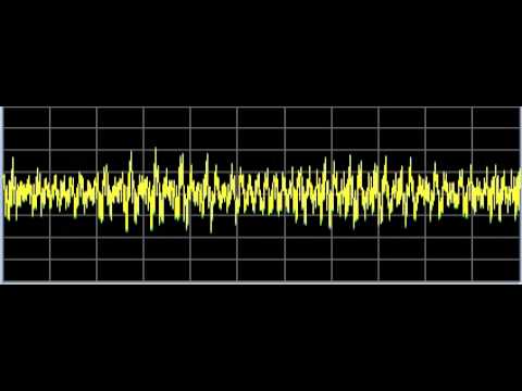 Diabetes 1 - Rife Frequencies