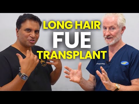 Long Hair FUE for Hair Transplant Surgery