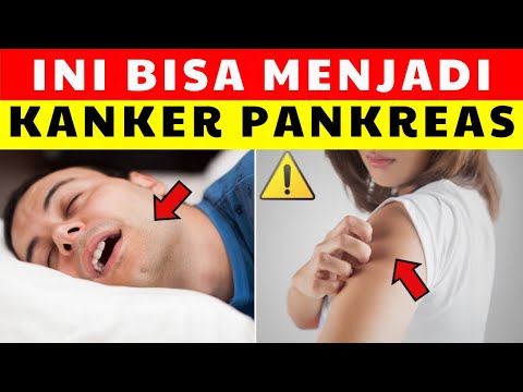 ‼️ 10 Tanda Awal Kanker Pankreas yang Sering Diabaikan 😱🩺 | Waspadai Sebelum Terlambat! ⚠️