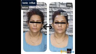 #medifacial #cosmetic #detanfacial #detanning #galvanic #sunburn