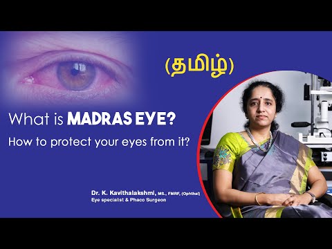 Reason & causes of Madras eye | How to cure Madras eye | Madras eye treatment in (தமிழ்)
