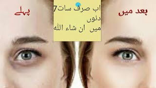 #Skencaretips #skincretipsinurdu #skincaretips #howtoremovedarkcircles skin|eye bags| home made tips
