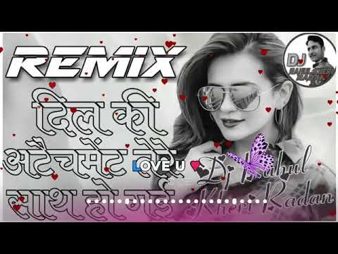 Dil Ki Atchamant Tara Shat Ho Gaye Remix Song