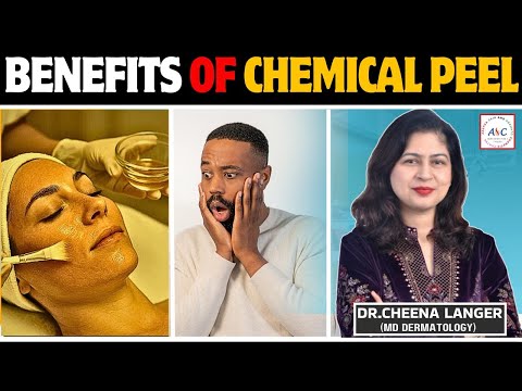 Chemical Peel Benefits | Dr. Cheena Langer | Best Skin Clinic for Chemical Peels in Jammu
