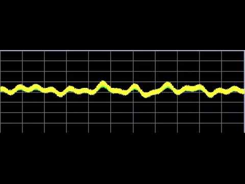 Hypothyroid - Rife Frequencies