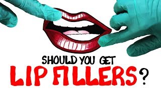 The Strange Science of Lip Fillers