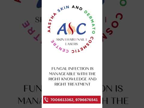 fungal infection I ring worm I fungal infection between toes