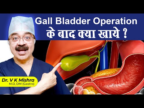 Gall Bladder Operation के बाद क्या खाये ? || HOW TO CHANGE YOUR DIET AFTER GALL BLADDER REMOVAL