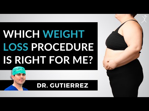 Which weight loss surgery procedure is right for me? | Question & Answers