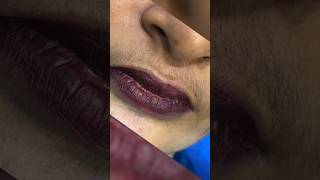 Upper lips waxing by rica brazilian wax #waxing #waxingathome #waxingtips #ricawax #skincare #beauty