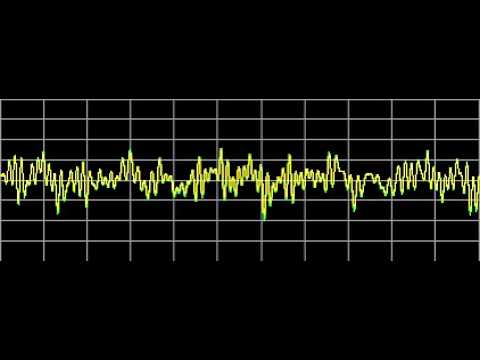 Anemia - Rife Frequencies