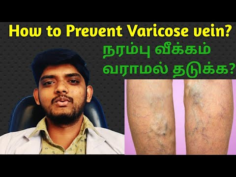 How to Prevent Vericose Vein, நரம்பு வீக்கம் வராமல் இருக்க? Vericose Vein Treatment,Episode-6...