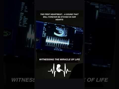 First Heartbeat Sound 🔊 🥰 बेबी की पहली धड़कन सुनी है? Heartbeat Ultrasound #heartbeat #ultrasound