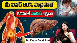 10 Symptoms of Liver Problem | Fatty Liver Symptoms | liver damage Sign | Dr Kavya Dendukuri
