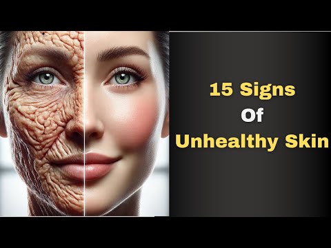 15 Signs Of Unhealthy Skin | 2025