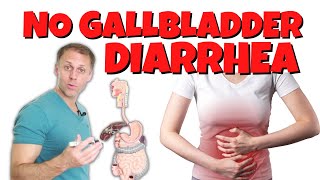 Diarrhea or Loose Stools After Gallbladder Removal