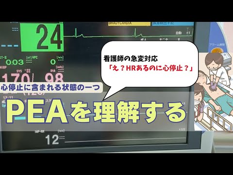 看護師の急変対応！心停止に含まれる状態の一つ「PEAを理解する」(BLS/ACLS)