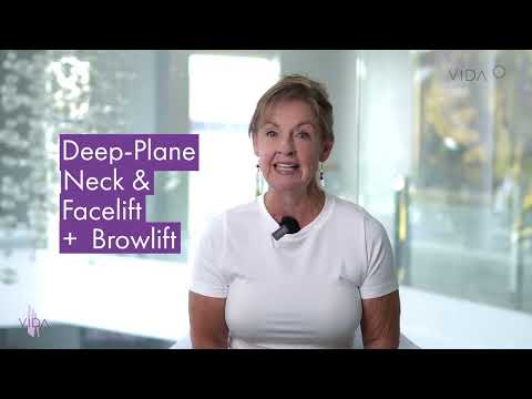 Dr. Quiroz's Magic: Delores' Face and Neck Lift Experience