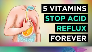 5 Vitamins To Stop ACID REFLUX Naturally