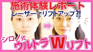 たるみ治療【サーマクールFLX＋ウルセラ】の効果を検証してみました！