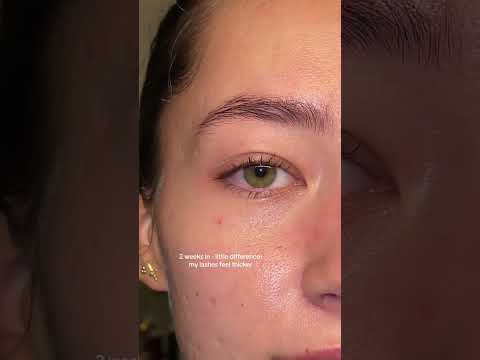 Nanolash - eyelash serum that works! #nanolash #eyelashserum #lashserum #eyelashgrowth