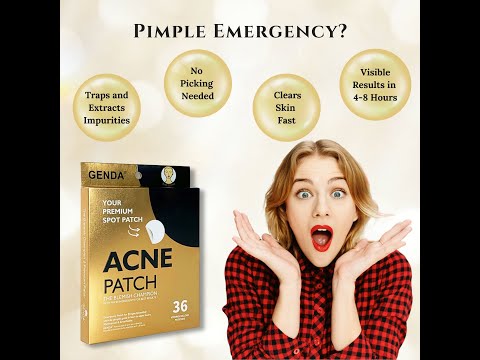 😱 "Goodbye Pimples Overnight?! You NEED This! ✨"