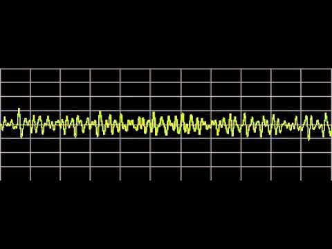 Tinea Versicolor - Rife Frequencies