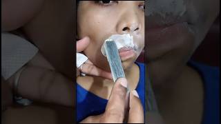 Upper lips waxing #shorts