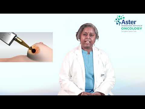 IORT | Dr. Prathima Sivaguru, Associate Consultant - Radiation Oncology at Aster CMI Hospital.