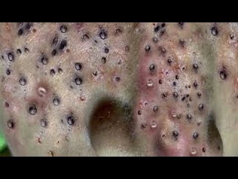 Relaxing Skincare Routine Cleansing for a Peaceful Mind #877910086