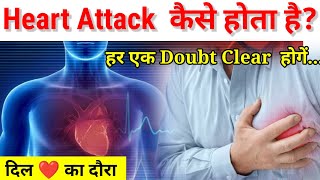 Heart Attack|दिल का दौरा|Reason And Types Of Heart Attack|Easy Explanation In Hindi #general_science