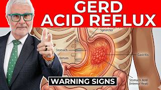 GERD and Acid Reflux Finally Explained: Attack the Root, Not the Symptom | Dr. Gundry