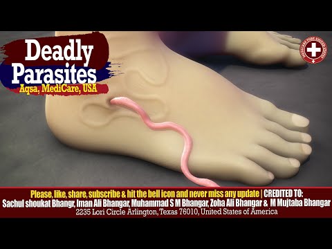 Deadly Parasites and Their Prevention | Avoid Life-Threatening Infections