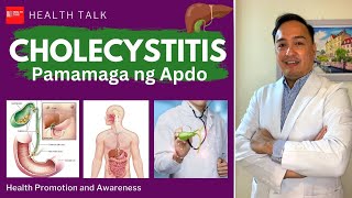 Cholecystitis (Pamamaga ng Apdo): Symptoms, Risk factors, Prevention and Treatment