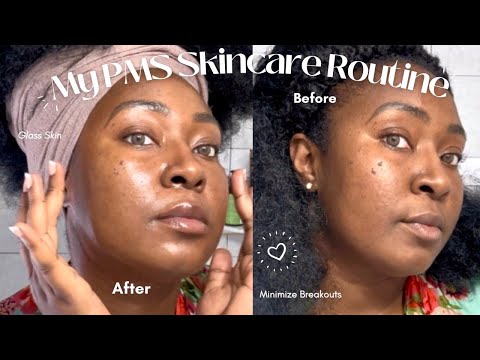 PMS SKINCARE ROUTINE | TREATMENTS + DAILY SKINCARE FOR HORMONAL SKIN | TANELLE IRENE