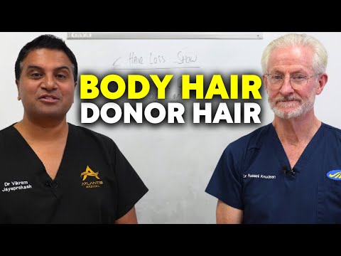 Body Hair As Donor Hair | The Hair Loss Show