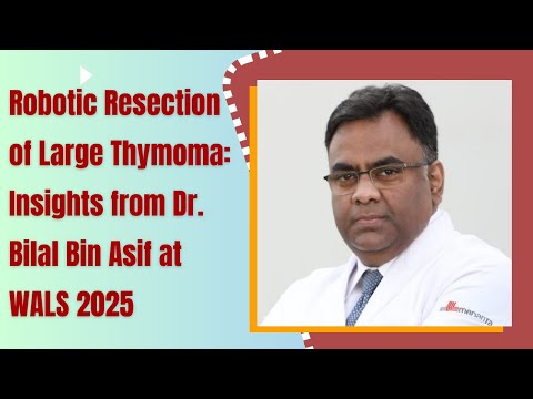 Robotic Resection of Large Thymoma: A Paradigm Shift Insights from Dr. Bilal Bin Asif at WALS 2025