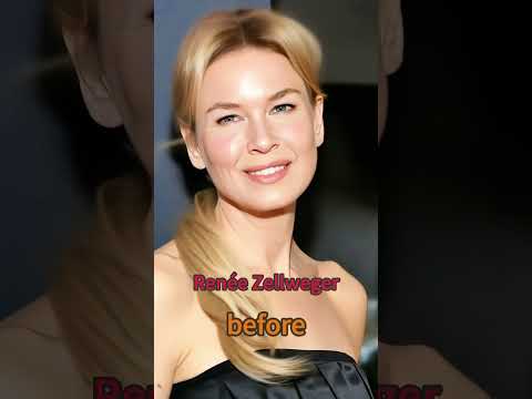 Here are 11 Hollywood celebs with huge post - weight - loss changes.#usa #celebrity #entertainment