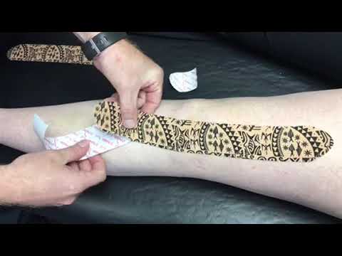 Dynamic Tape Demonstration for Anterior Knee Pain | Pro Physio