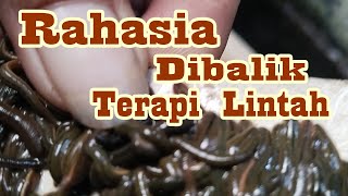 Cara Kerja Terapi Lintah