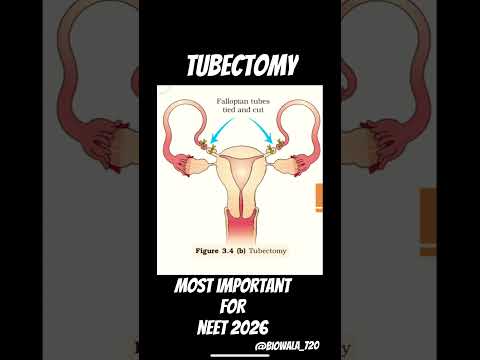 Human Reproduction ( Tubectomy ) #biology #neet #ncert #shorts #trending #science #viral #aiims