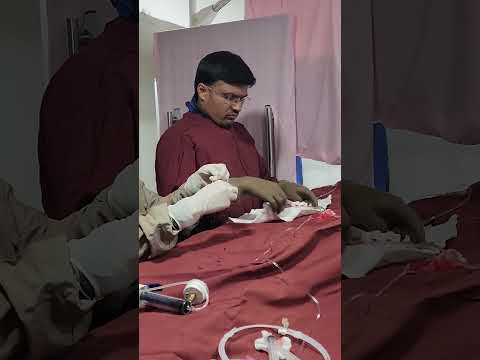 MINI VLOG DR NAVIN क्या हार्ट के ब्लॉकेज के लिए एंजियोप्लास्टी करना सही है 😥👇#vlog#shorts