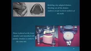 MISCELLANEOUS CLINICAL & LABORATORY PROCEDURES :(Relining, Rebasing and Repair of Complete Denture)