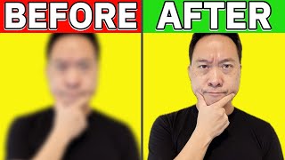 How To Fix Blurred Vision Naturally