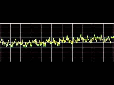 Osteoarthritis - Rife Frequencies