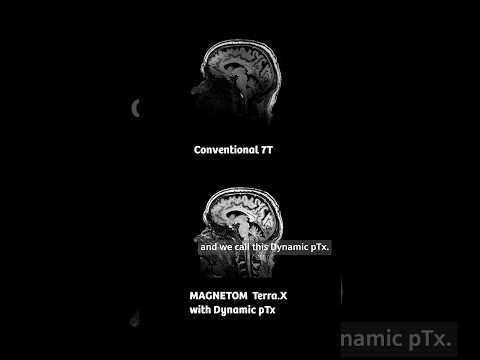 Image quality in 7T #MRI | #siemenshealthineers #radiology